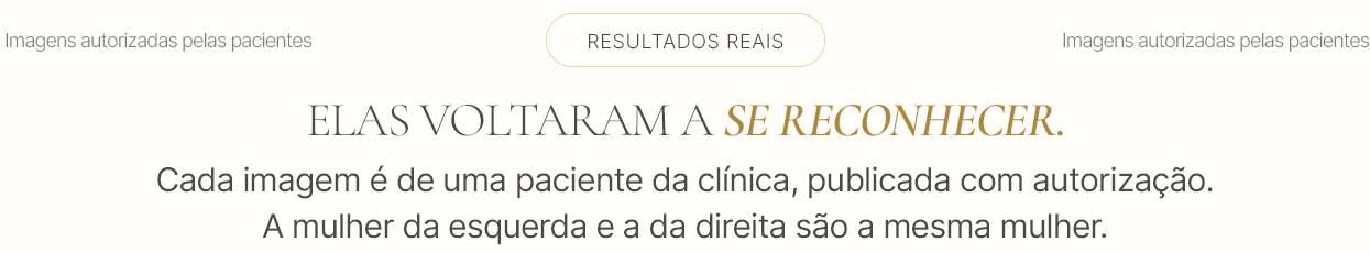 Resultados reais. Elas voltaram a se reconhecer. Cada imagem é de uma paciente da clínica, publicada com autorização. A mulher da esquerda e a da direita são a mesma mulher.